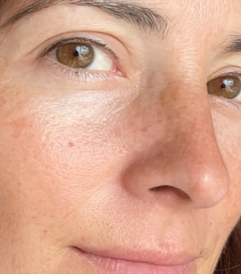 Kim, age 49 — BodyMatched before and after, brighter plumper skin